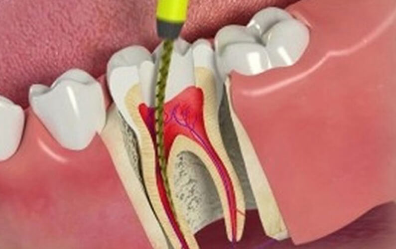 Decare Speciality Dental Clinic Kolappuram