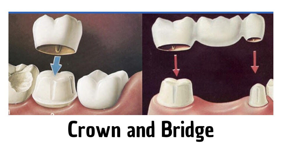 Decare Speciality Dental Clinic Kolappuram