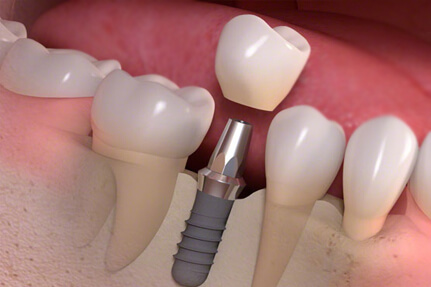 Decare Speciality Dental Clinic Kolappuram